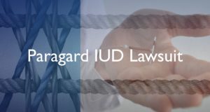 Paragard IUD Lawsuit